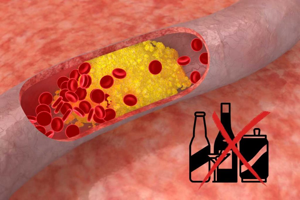 boisson à éviter pour le cholestérol