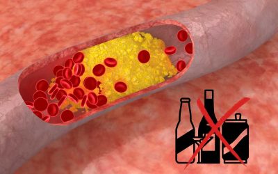 Quelles sont les boissons à éviter pour le cholestérol ?