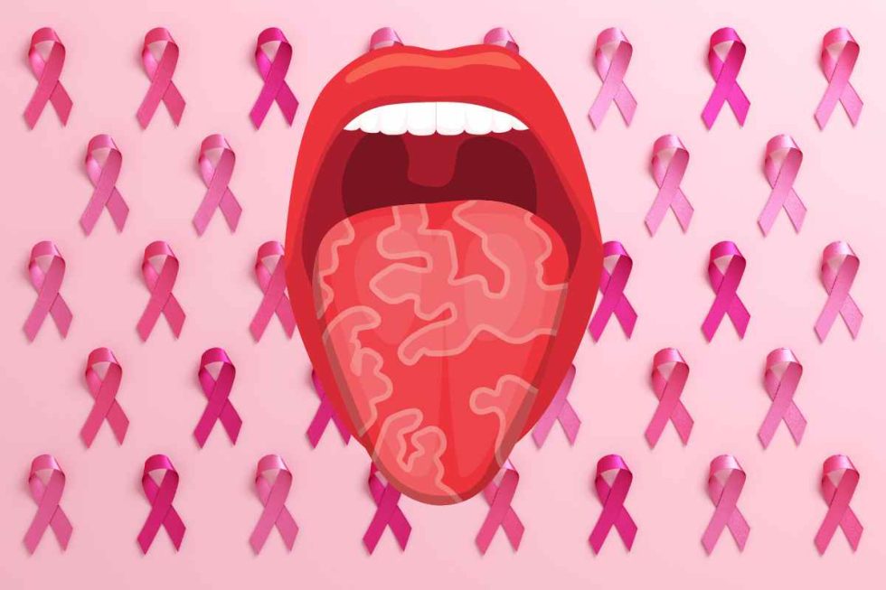 Comment meurt-on d'un cancer de la langue