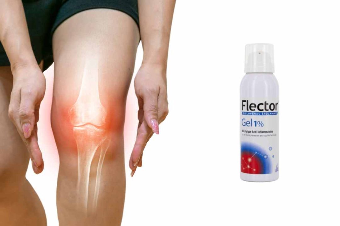 Flector gel : Combien de fois l'appliquer par jour