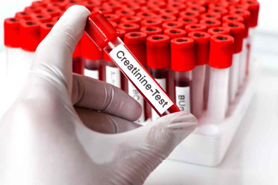 Quand faut-il s'inquiéter du niveau de créatinine