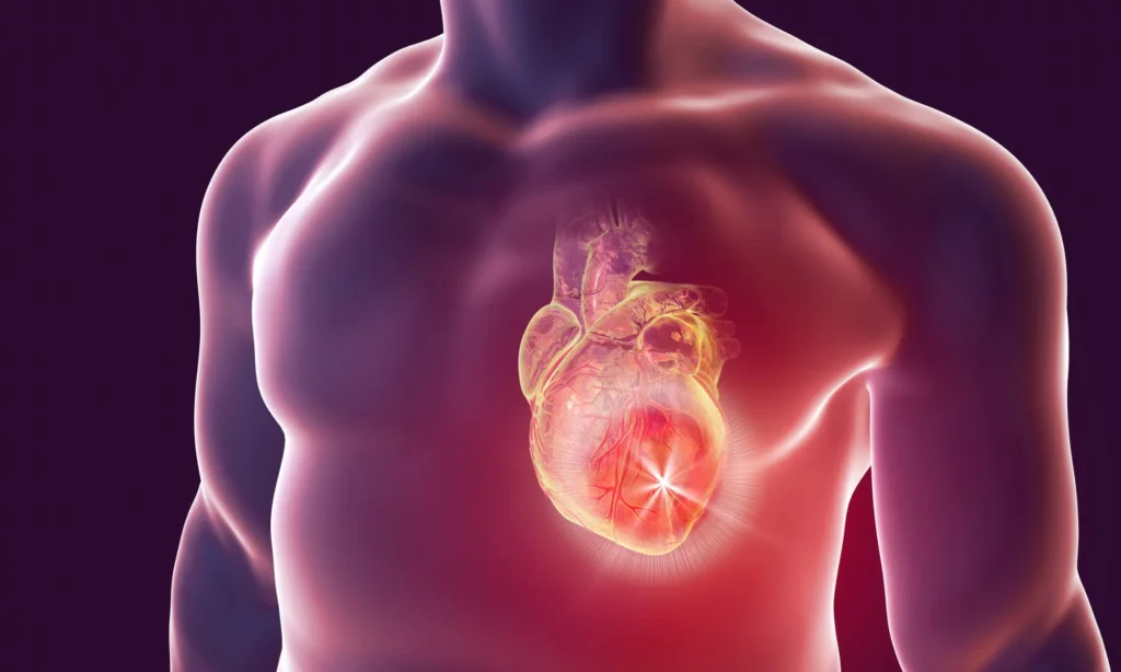 comment meurt on d'une insuffisance cardiaque